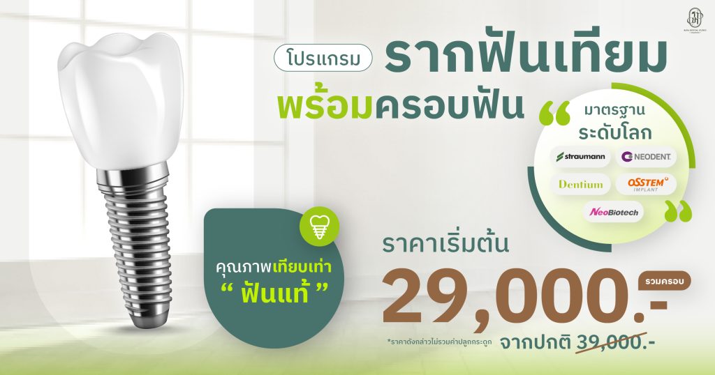 dental_implant_price_start_29000.jpg