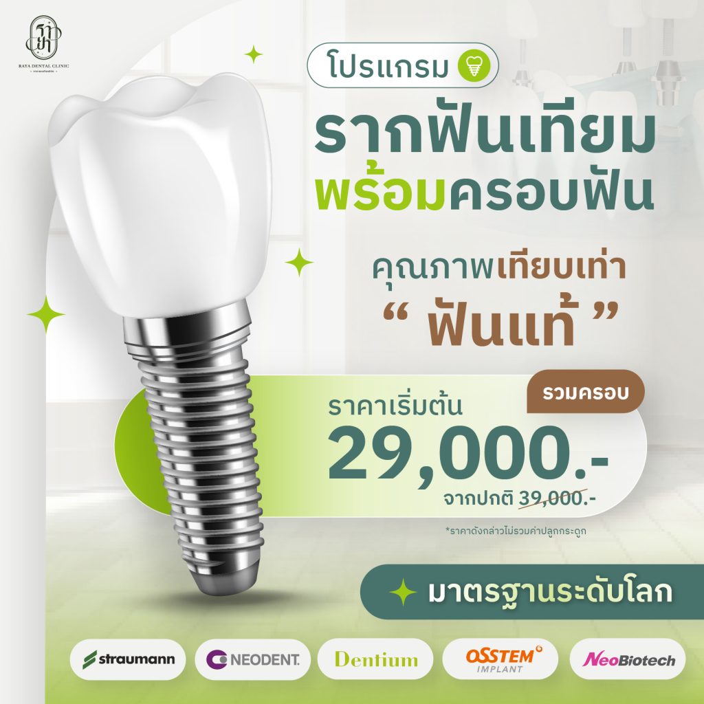 dental_implant_price_start_29000.jpg